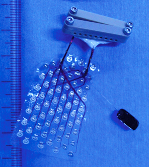 Subdural array electrode