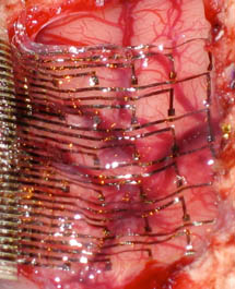 Smart Flesh electrode