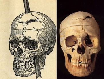 skull